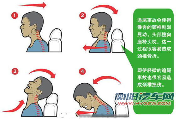 追尾时人体最易受伤的部位是颈椎